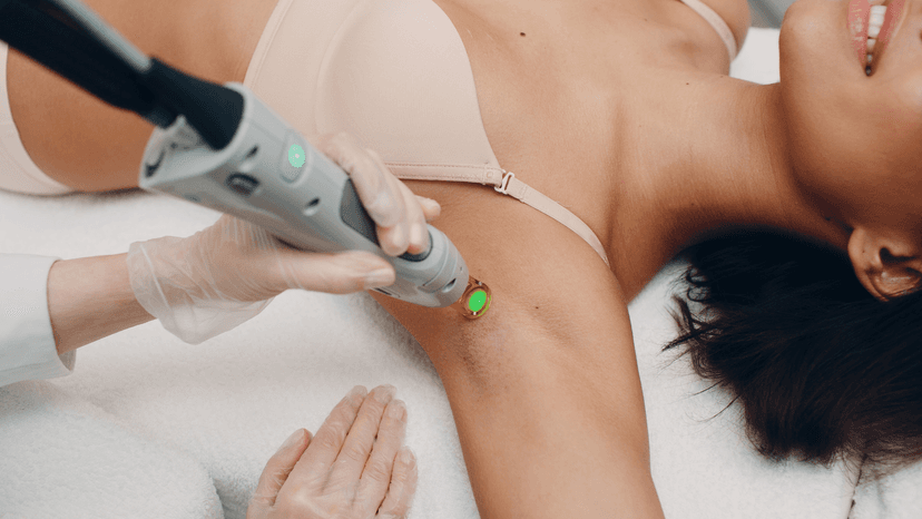 Depilacion Laser